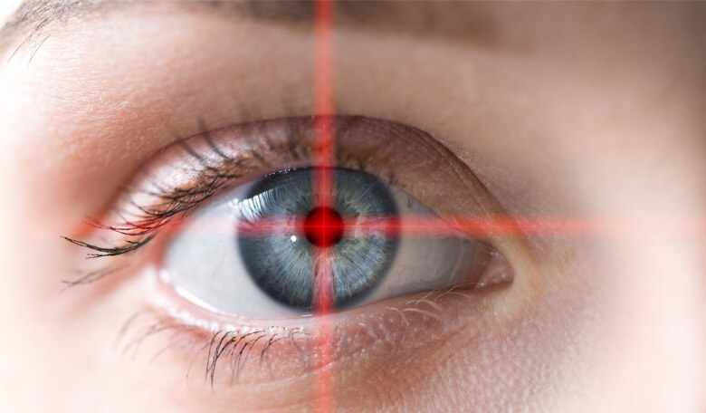 Cirurgia Refrativa - Miopia