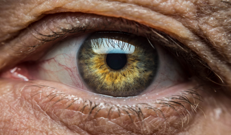 Degeneração Macular Relacionada à Idade (DMRI)