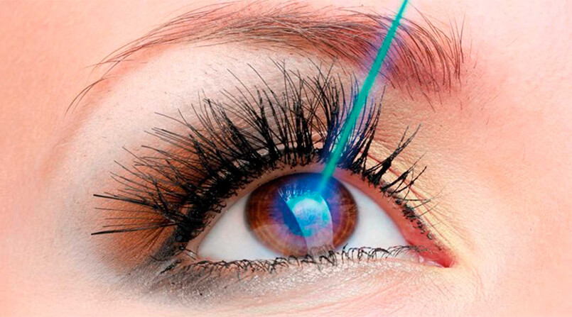 posso operar meu grau